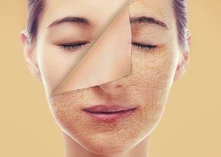 چه غذاهایی باعث جوش صورت میشوند؟ معرفی خوراکیهای جوشزا 3 نقش سلامت کبد در شفافی پوست