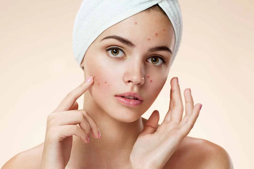 برای داشتن پوست شفاف چه بخوریم